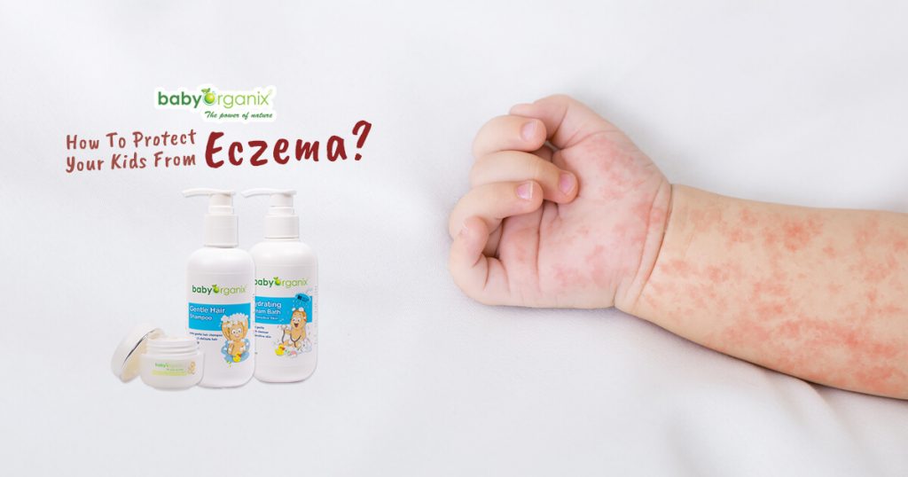How To Protect Your Kids From Eczema BabyOrganix Knows How!